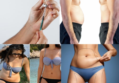 The Power of Peptides: Unlocking the Science Behind Fat Loss and Muscle Gain