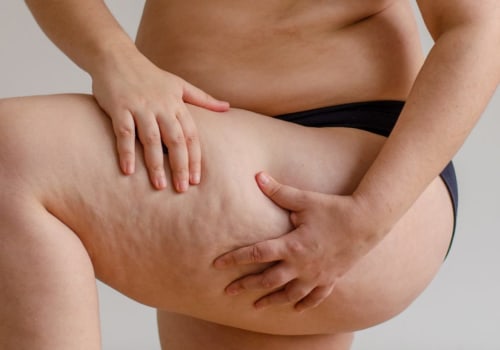 The Truth About Peptides: Benefits and Risks for Fat Loss and Muscle Gain